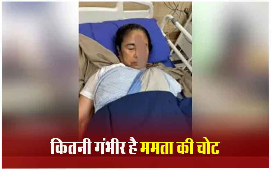 कितनी गंभीर है ममता बनर्जी की चोट, क्या किसी ने पीछे से दिया था बंगाल सीएम को धक्का?