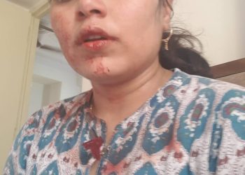 तेरे मरने से लोन माफ हो जाएगा… MP में 35 लाख के लिए पति ने पिलाया पत्नी को फिनाइल, पीड़िता ने बताई दास्तां