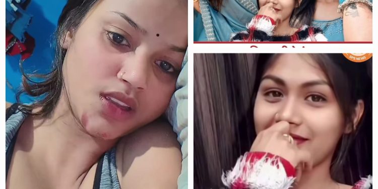 बातचीत के बहाने होटल बुलाया फिर… छत्तीसगढ़ में 25 साल की लड़की ने 16 साल के लड़के से किया रेप, पुलिस ने युवती को किया गिरफ्तार