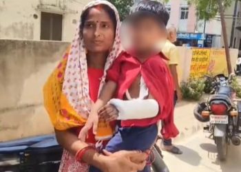 Deoria Medical College Negligence: बच्ची के दाहिने हाथ में था फ्रैक्चर, डॉक्टरों ने बाएं हाथ पर चढ़ा दिया प्लास्टर, UP में डॉक्टरों ने किया गजब कारनामा, अब होगा एक्शन.?