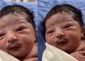 Viral Video:मूंछों के साथ पैदा हुआ बच्चा? दुनिया का ये पहला मामला, सोशल मीडिया पर वीडियो हुआ वायरल