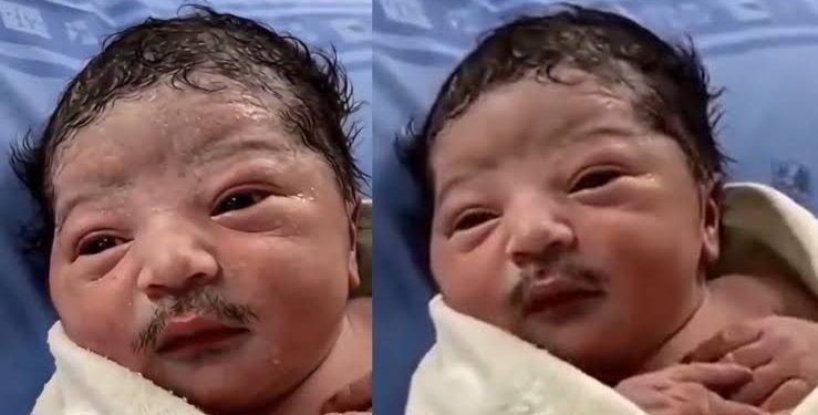 Viral Video:मूंछों के साथ पैदा हुआ बच्चा? दुनिया का ये पहला मामला, सोशल मीडिया पर वीडियो हुआ वायरल